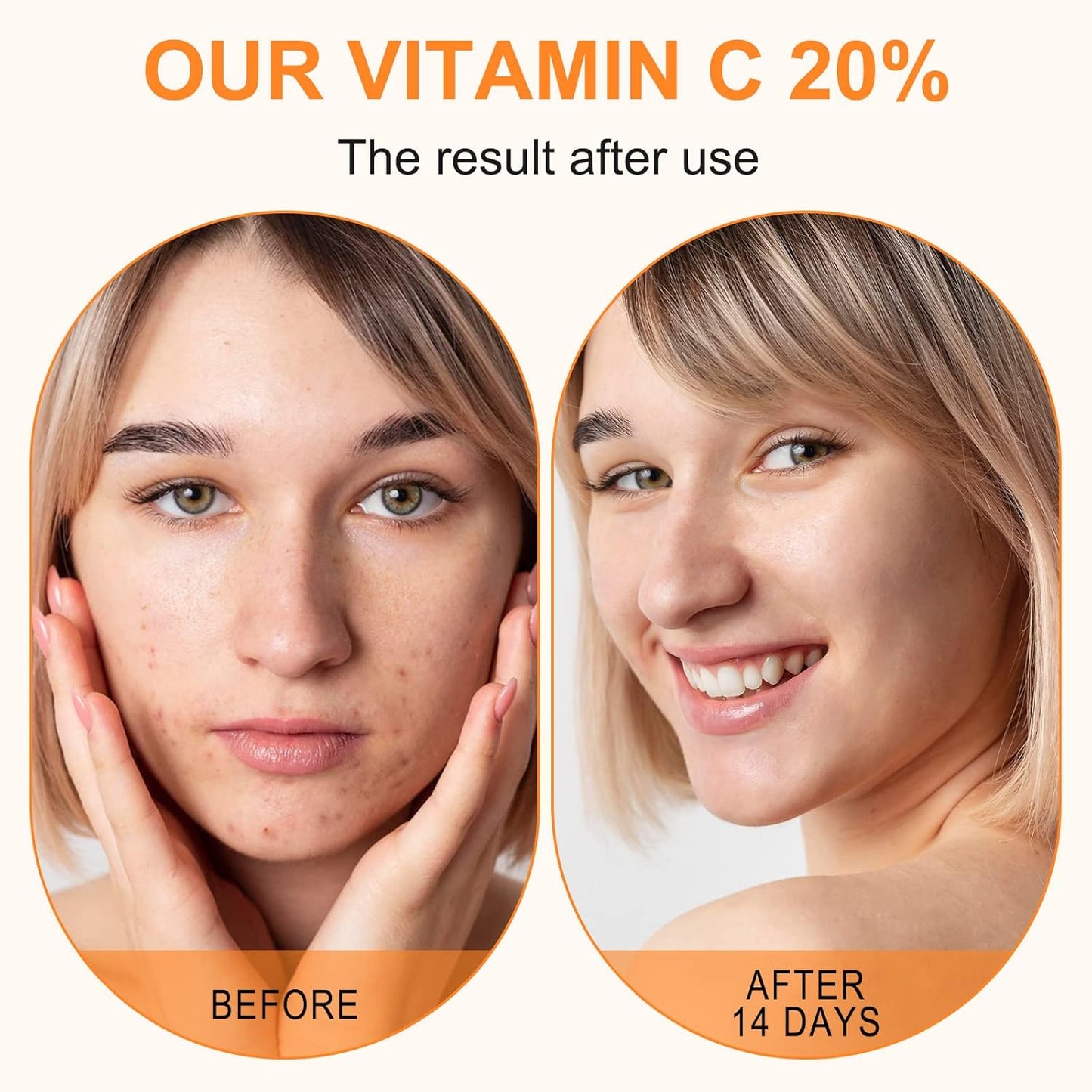 Premium 20% Vitamin C Serum For Face with Hyaluronic Acid, Retinol & Amino Acids - Boost Skin Collagen,Hydrate & Plump Skin, Anti Aging & Wrinkle Facial Serum 60ml